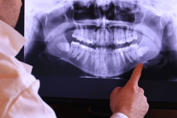 Best Emergency Treatment for Dental Infections or Abscesses in Bethesda, OH