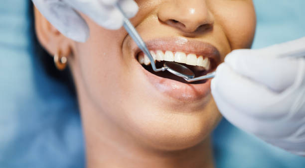 Best Urgent Care for Lost Fillings or Crowns in Bethesda, OH