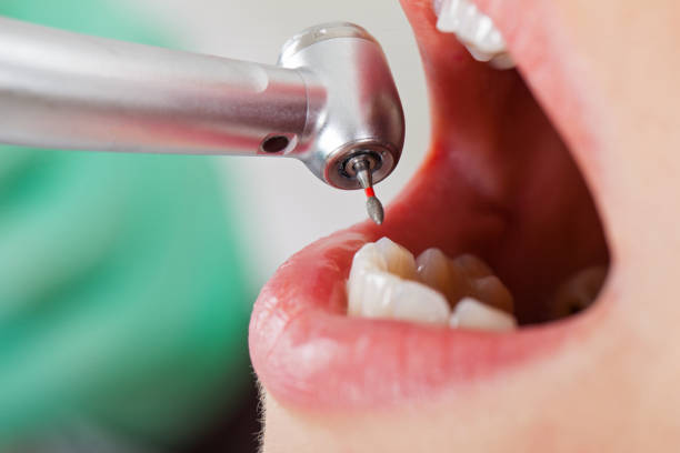 Best Weekend Emergency Dentist in Bethesda, OH
